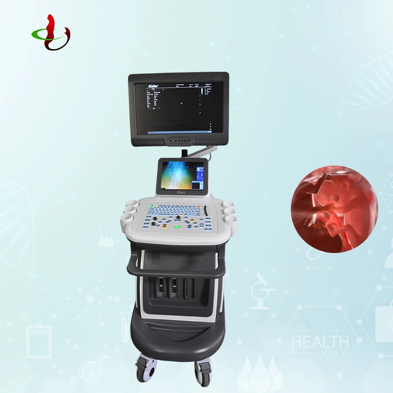 Индивидуальный цветной допплер 4d эхосонография, ультразвуковой сканер, ультразвуковой сканер, зонд объема 4D