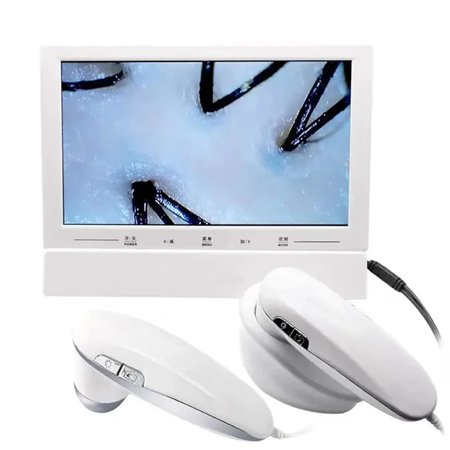 SA-S16 портативный 11 дюймов HD-экран детектор пор кожи волосяные фолликулы сканер