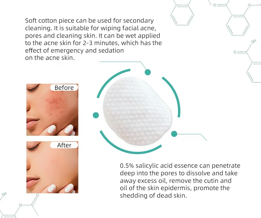 OEM Private Label 0.5% Salicylic Acid Balancing & Conditioning Acne Treatment Cotton Pads for Oily Skin