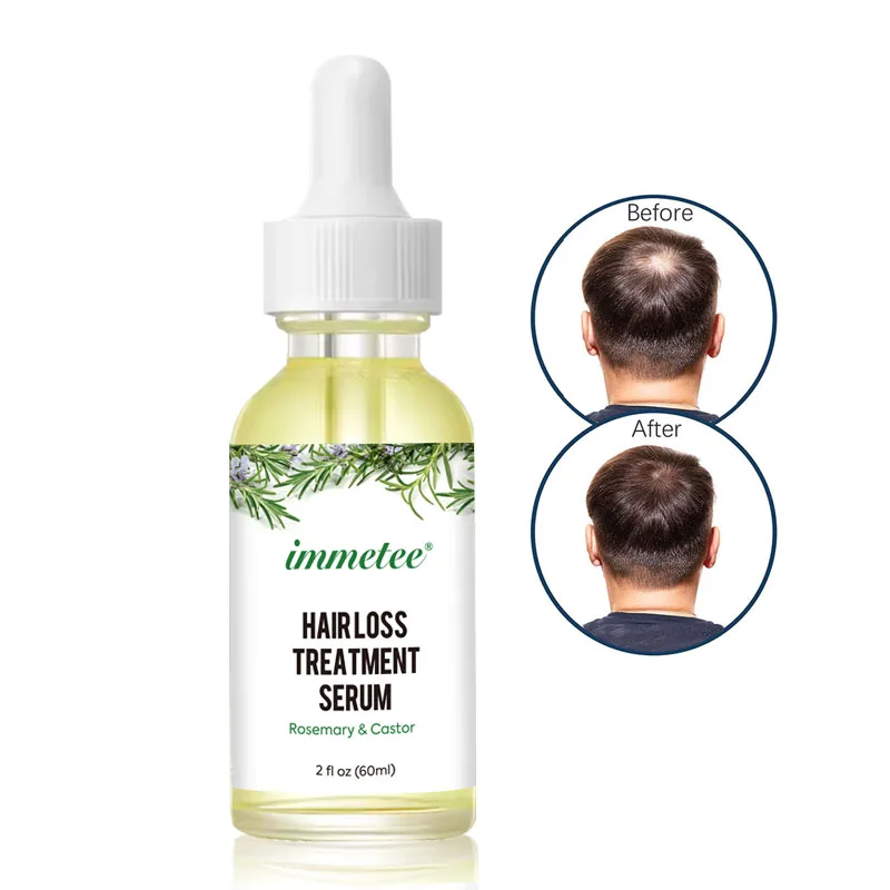 Rosemary Oil Hair Growth Private Label Natural Organic Rosemary Castor Scalp Care Serum Hair Treatment Growth Oil