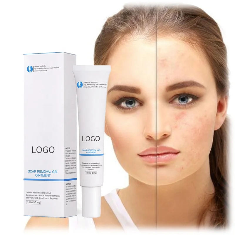 New Arrive 30g Organic Herbal Repair Gel New Old Scars Skin Face Body Scar Removal Gel Ointment