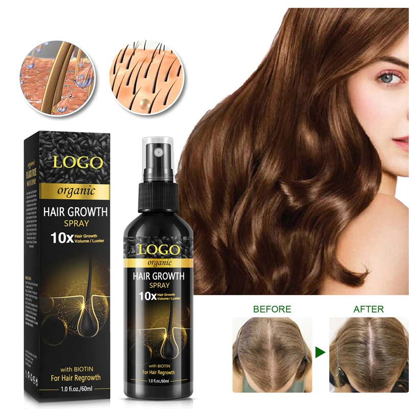 Unlock Vibrant Hair with Black Rice water Hair Growth Spray and Hair Growth Spray  OEM
