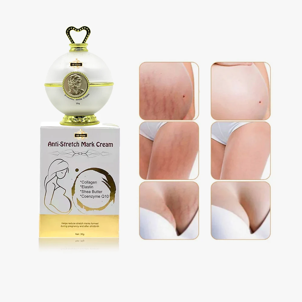 OEM Best Natural Soothing Safe Pregnancy Strong Effective Stretch Mark Remover Oil Body Fast Repair Stretch Marks Cream