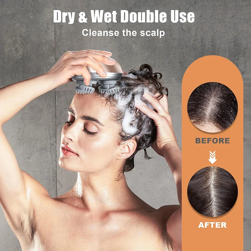 Removable Recharging Silicone Vibrating Waterproof Hair Head Massage Deep Cleaning Scalp Massager