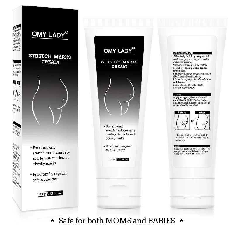 Лидер продаж, Камбоджа, крем для удаления шрамов и темных следов от растяжек для беременных