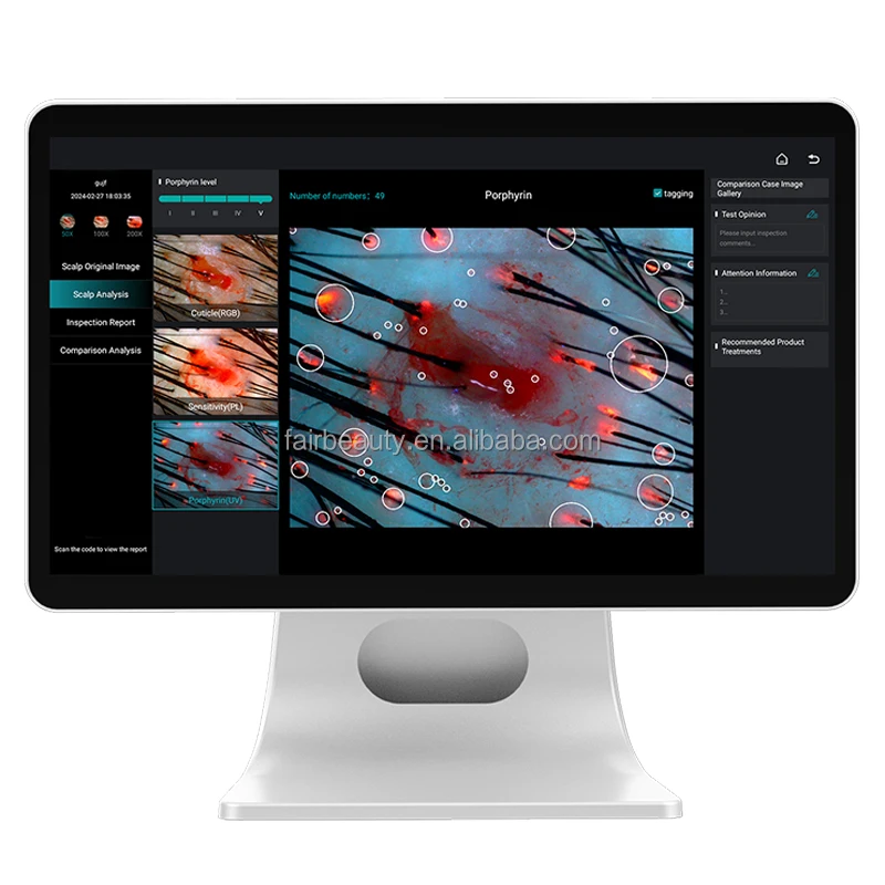 AI Intelligent Analysis Hair Tester Skin Analyzer Analysis Scalp Care With Cloud Data Storage Hair Analysis Machine