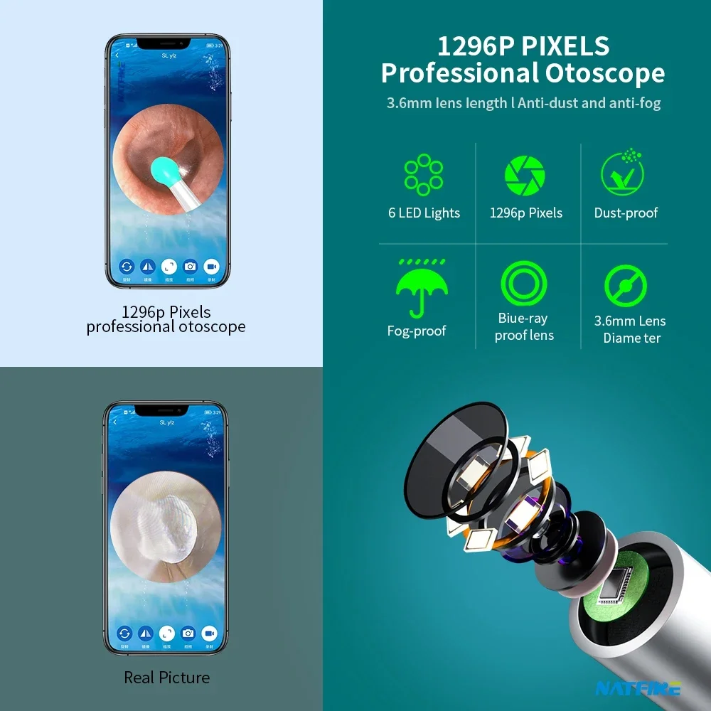 Home Use Portable Wifi Otoscope Camera Ear Wax Remover Intelligent  Visual Ear Cleaner Ear Wax Cleaner