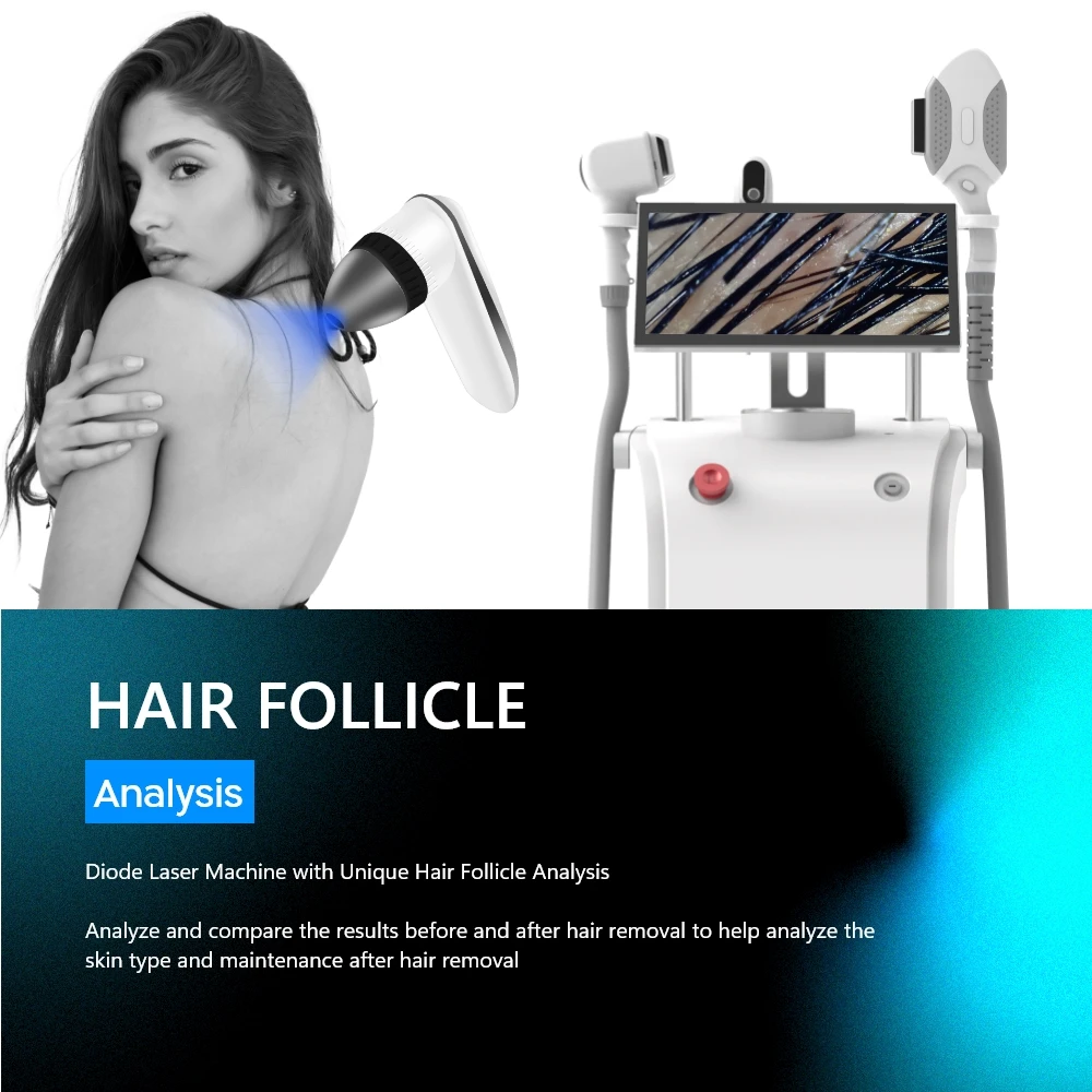 Two handles painless new DPL 808nm diode laser hair removal machine