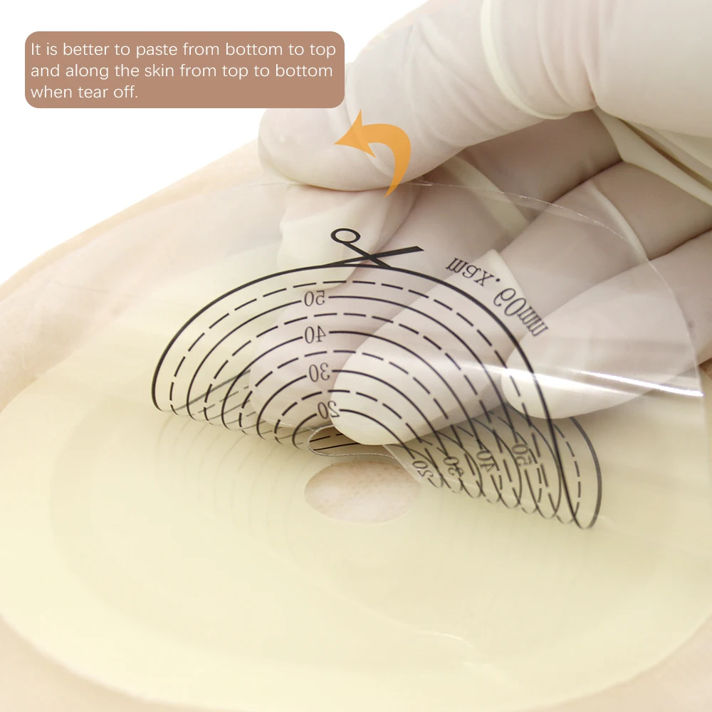 Manufacturer Direct Supply of Medical Supplies One - Piece Type Double Layer Yellow Non-woven Shaped Colostomy Bag