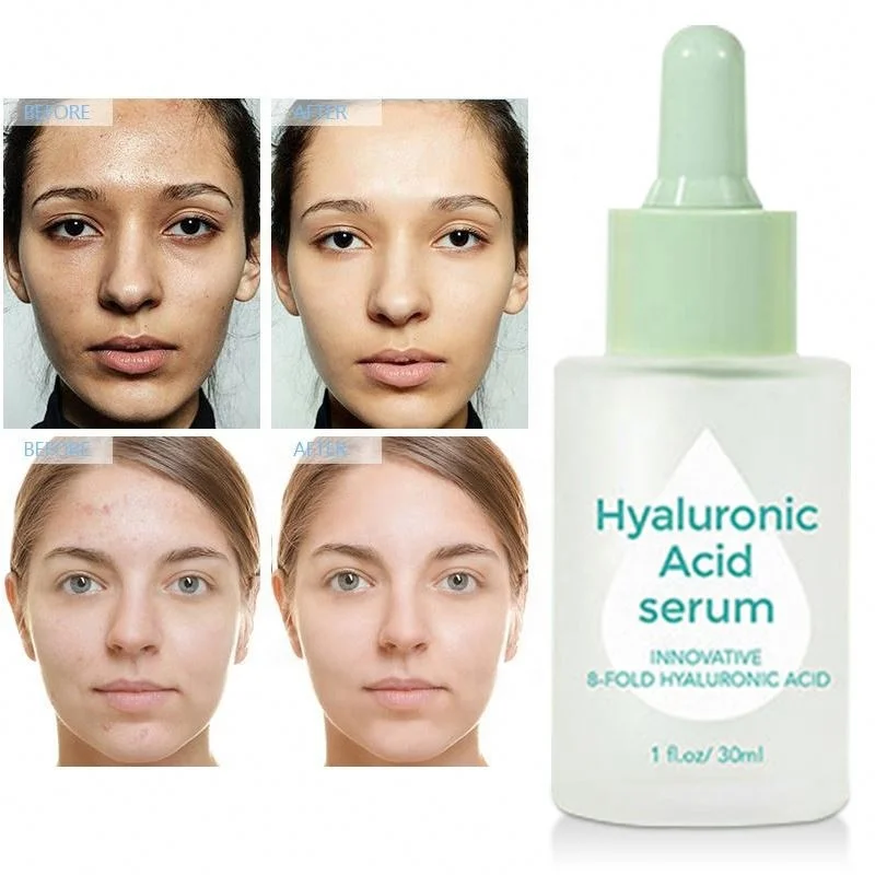 Natural Vitamin C Hyaluronic Acid Niacinamide CollagenAnti AgingWrink ReduceFine Line lesmoisturizing hydratingskinCare Serum