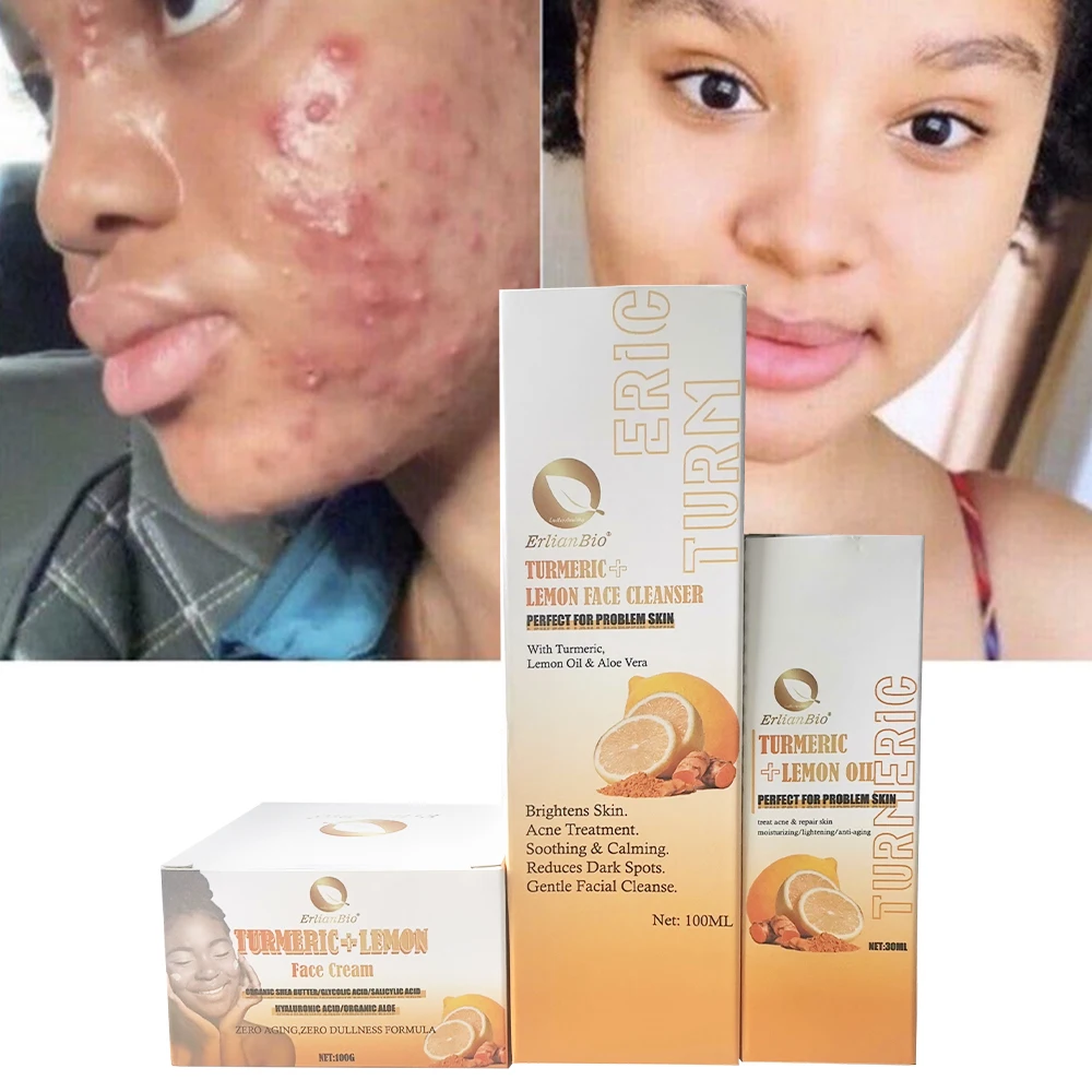 Turmeric Brightening Skin Set Acne Spot Removal Facial Cleaning Moisturizing Serum Cream Face Cleansing  Skincare Set