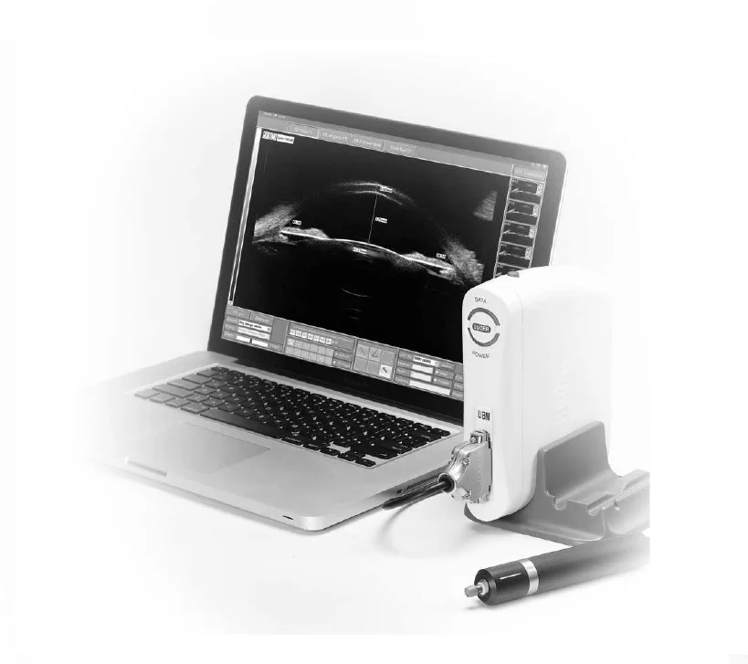 Professional Ophthalmic Ultrasound UBM Ultrasound Biomicroscope for Ophthalmic Clinic