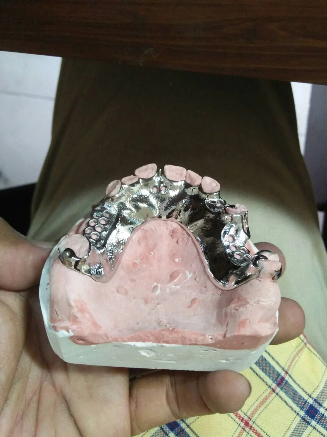 Popular Product Dental Consumable High Quality Alloy NB NP CC SOFT PS TS Used For Dental Lab