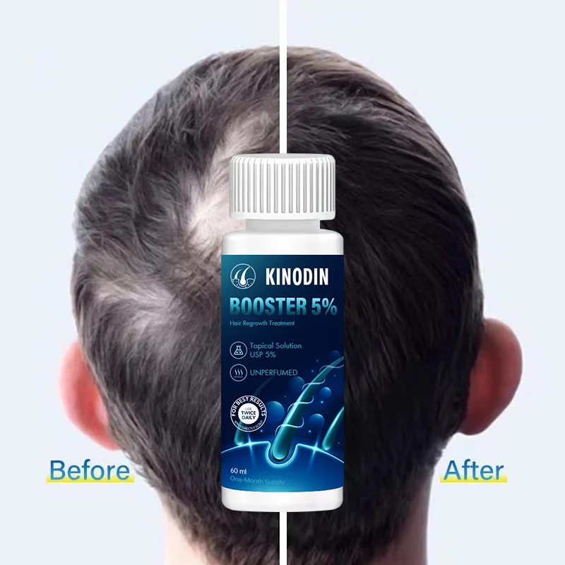 KINODIN Super Fast Hair Growth Serum Tonic hair growth 60ml 5%  Prevents Hair Loss Russia xinoxin Growth Serum