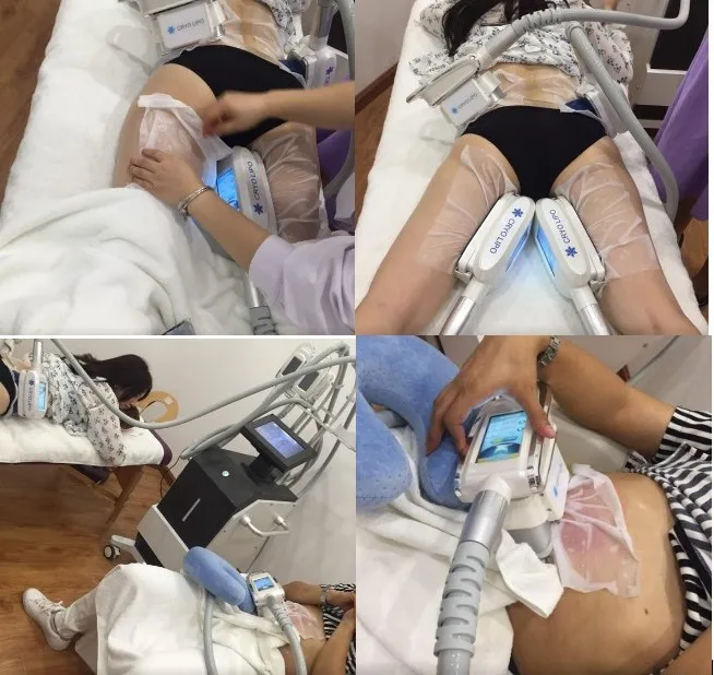 Innovative 360 cryotherapy body coolsculption cryolipolysis slimming machine