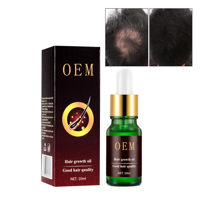 Anti Loss Treatment Hair Care Ginger Treatment Serum Dry Frizzy Damaged Thinning Scalp Growth Essential Oils