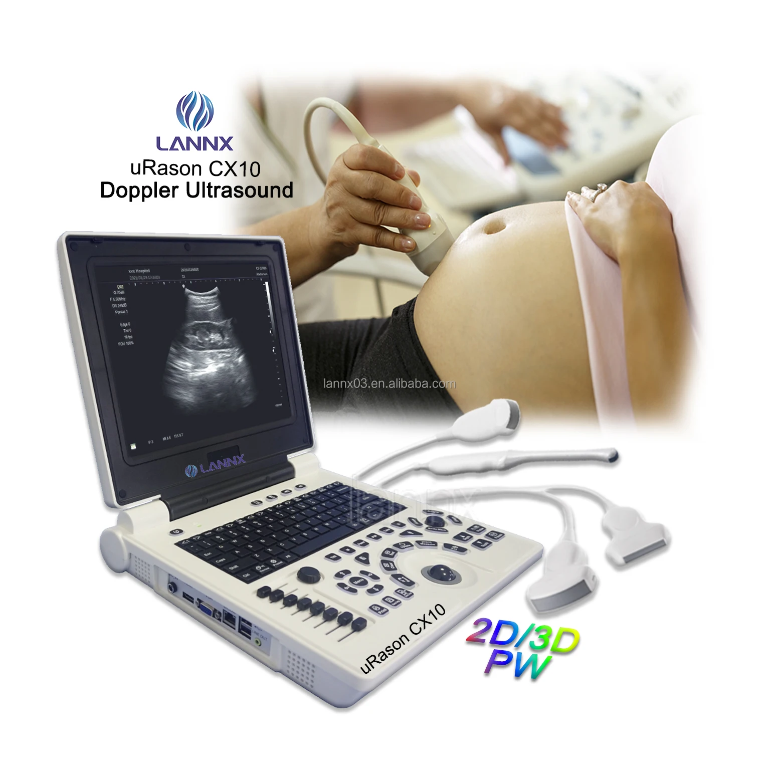 LANNX uRason CX10 High Quality Cardiac OB GYN Echocardiography Machine ecografo portatil Laptop Portable Ultrasound Scanner