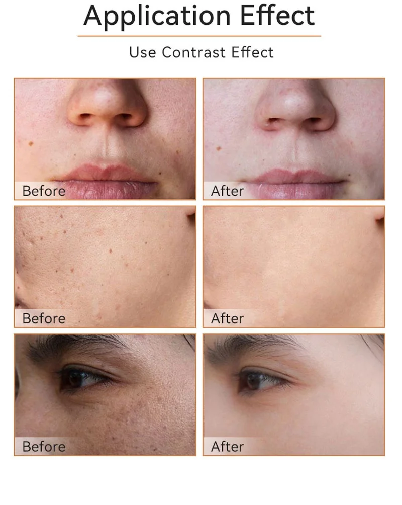 Wholesale Customization Turmeric Toner organic vegan  acne private label turmeric skin care set wholesale