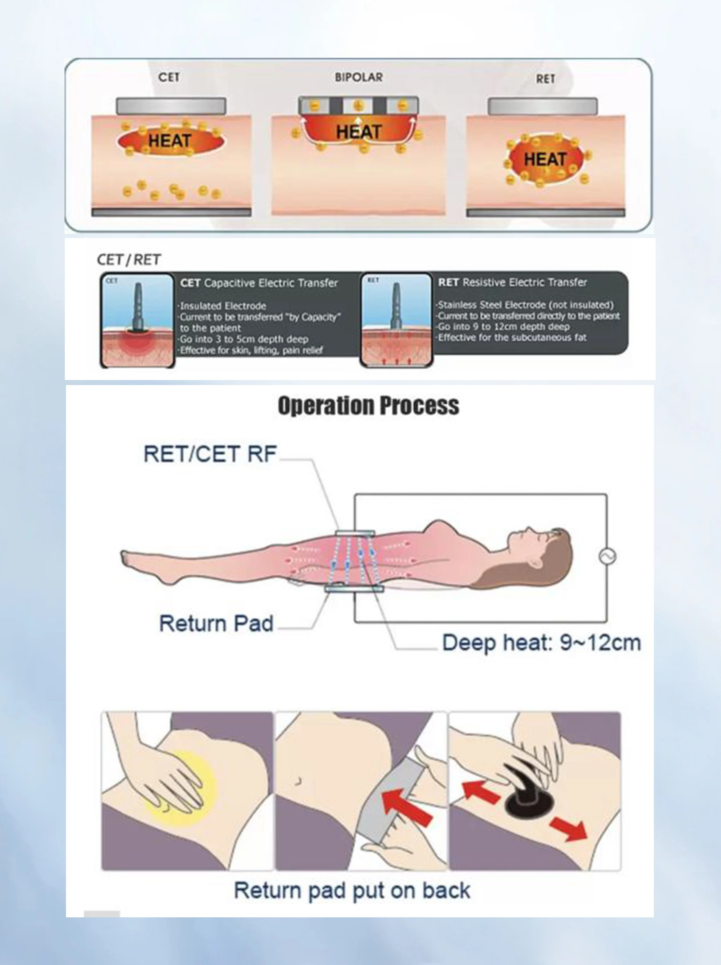 BECO 2024 newest cellulite 3 handles mono polar fat reduction portable radio frequency body sculpting machine