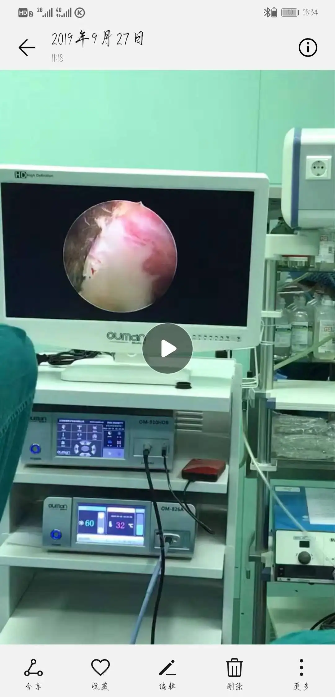 UHD camera endoscopy 4k medical surgery associated equipments for laparoscopic price