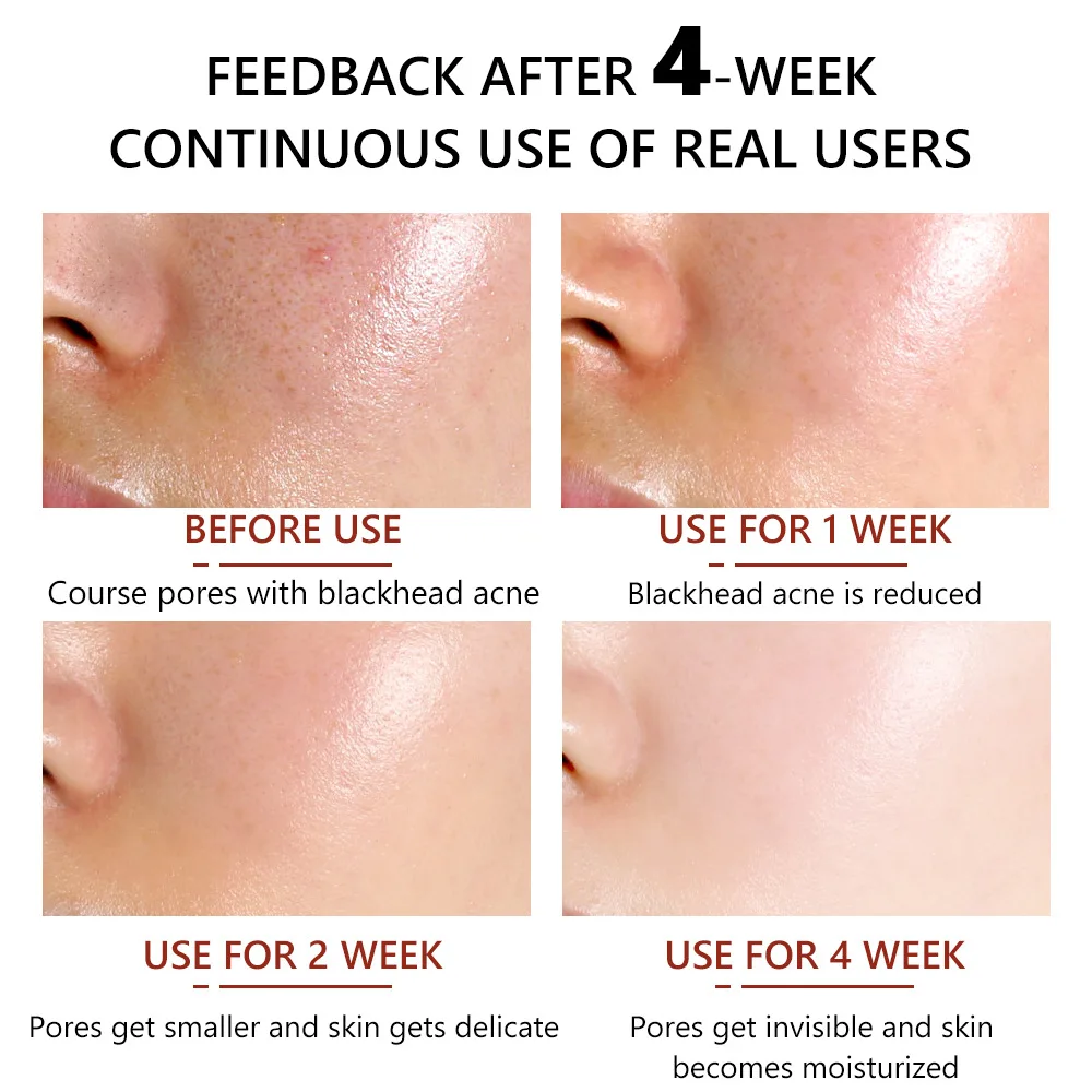 New Skin Care Serum Facial Whitening Anti Age Face Serum with 30% Vitamin C 5% Niacinamide 10% Vitamin E Serum