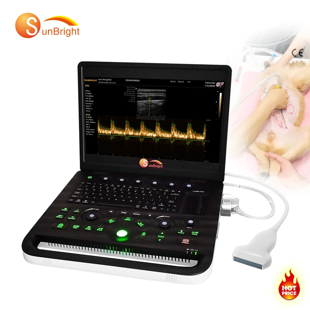 CE Best price Battery Laptop 15 Inches LED ultrasound machine price/Laptop Ultrasound Scanner