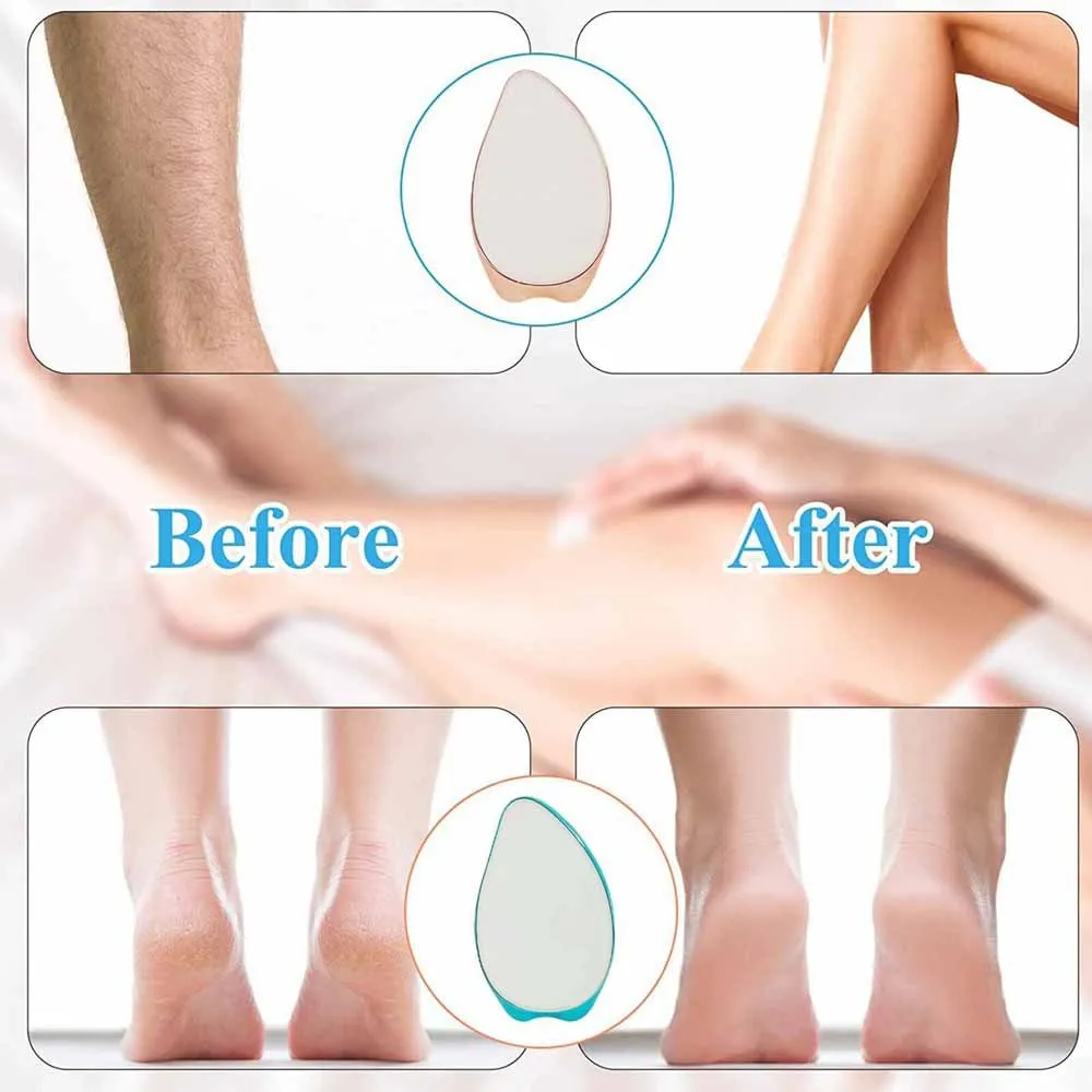 Wholesale body painless hair removal erase magic glass nano crystal hair remover machine