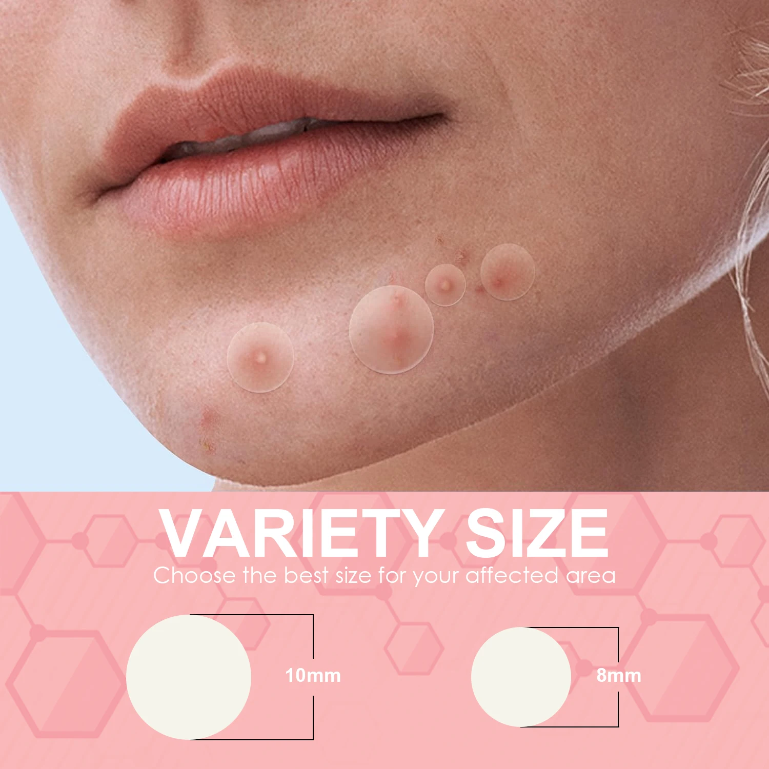 Private Label Hydrocolloid Acne Pimple Patch for Covering Zits and Blemishes