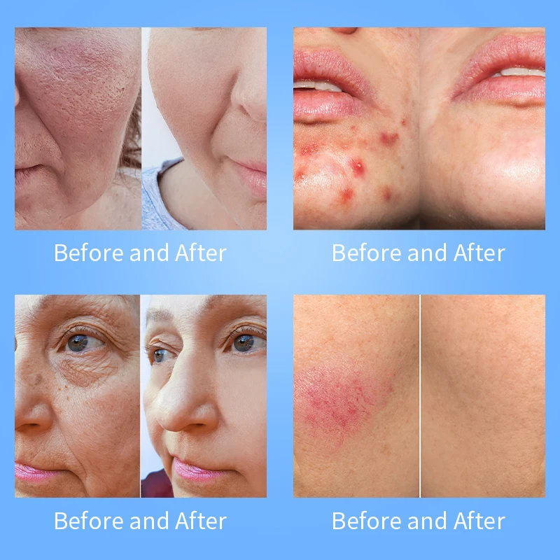 Profesional 12 en 1 Machine Analizador De Piel Facials Maquina 6/7/8/14 en 1facial Machine