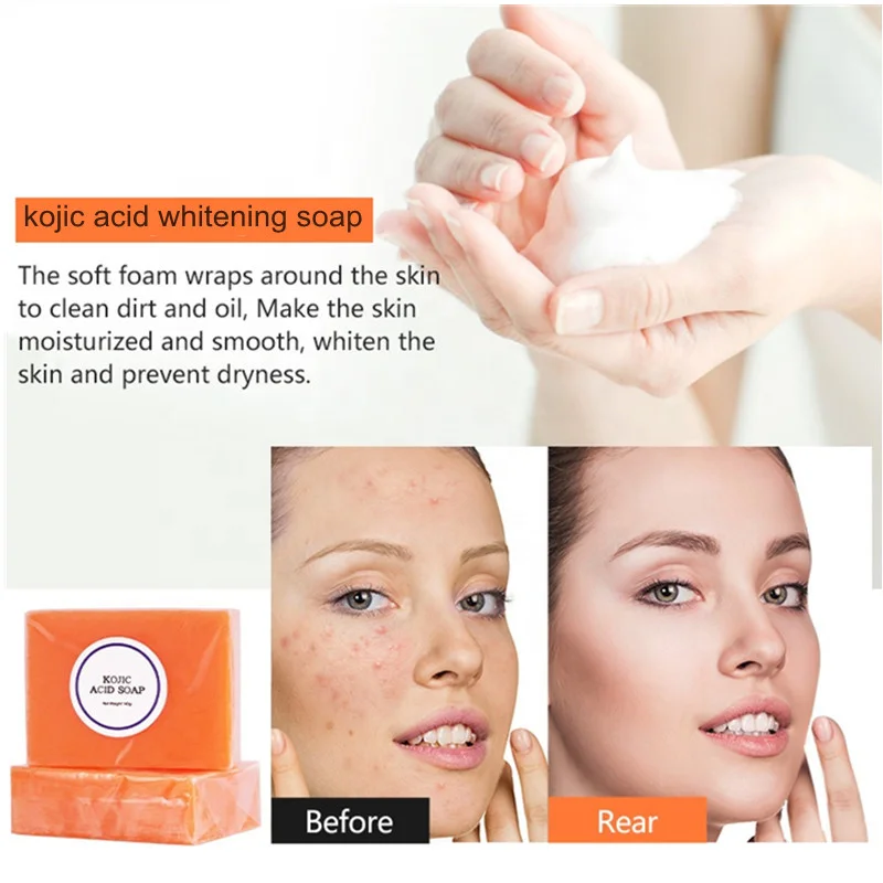 140g Wholesale Private Label For Face Bath Organic Cleaning  Bamboo Charcoal turmeric kojic acid papaya rose whitening Soap