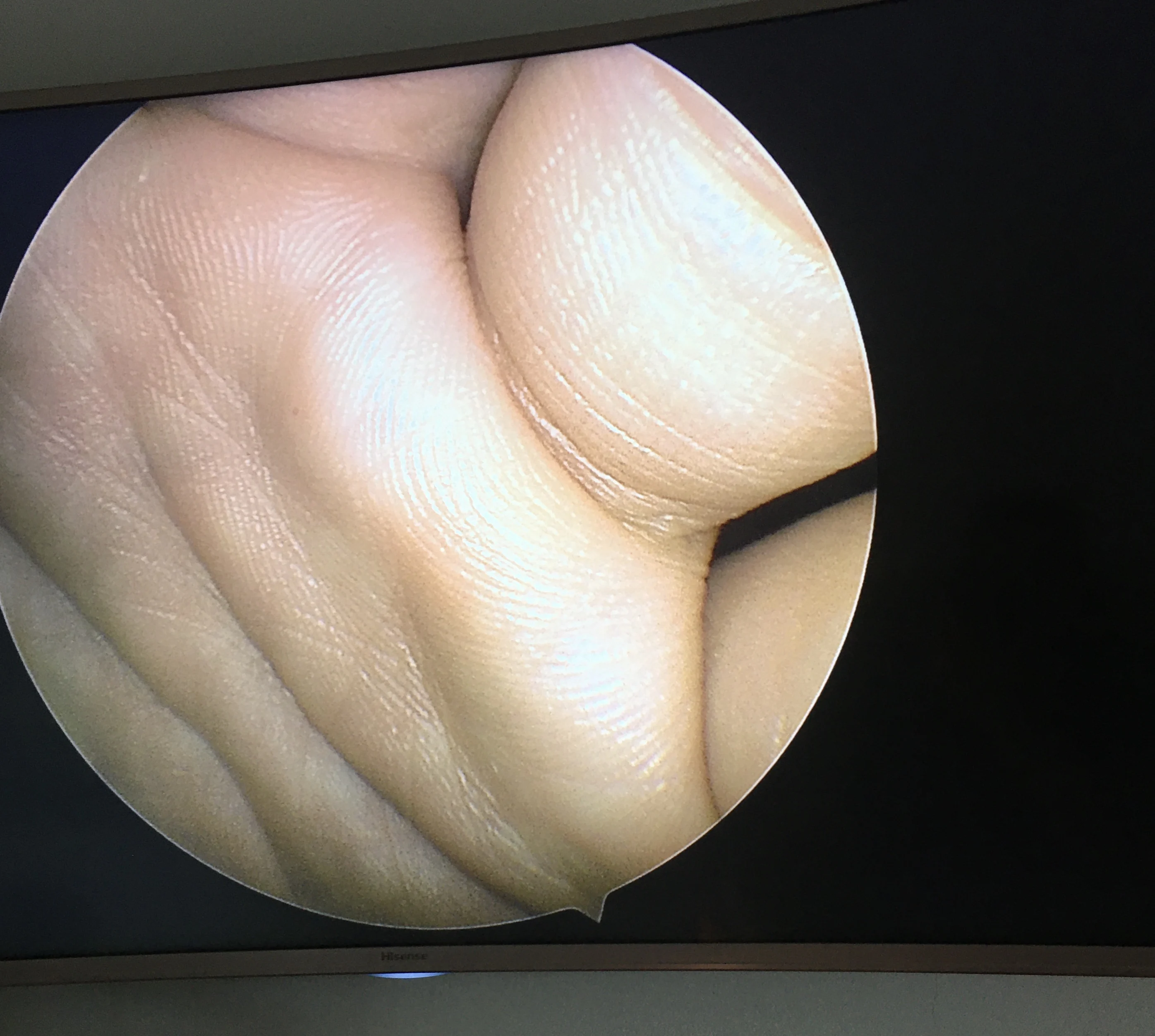 Эндоскопическая камера Full HD