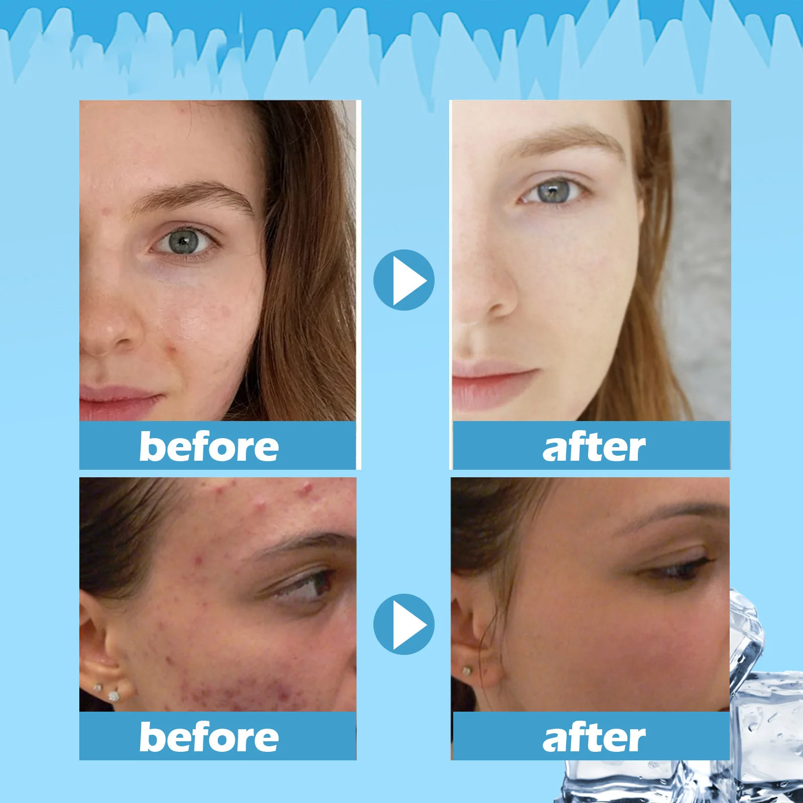 EELHOE Moisturizing Sleep Mask Facial Moisturizer Universal Face Moisturizer Facial Collagen Mask 3 Years Anti-wrinkle Crystal