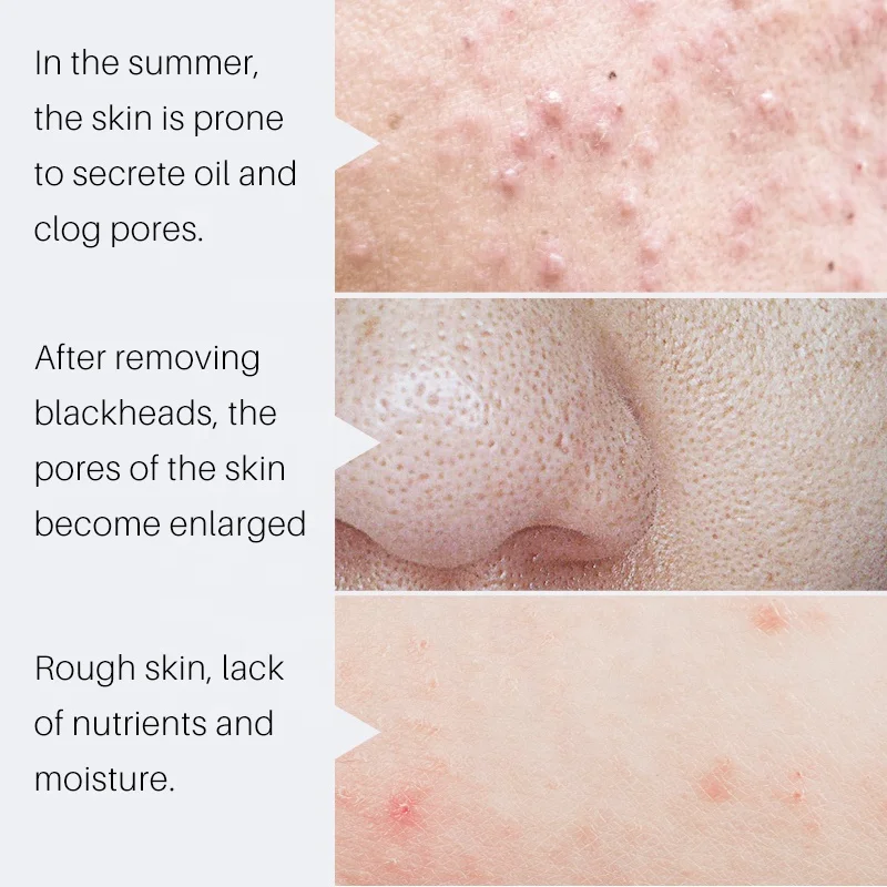 SAUVASINE  pore minimizer serum for shrinking unclogs enlarged pore anti ance serum