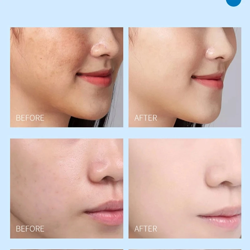 Private label OEM  ampoule stem cell alpha arbutin niacinamide retinol hyaluronic acid anti aging whitening  vitamin c serum