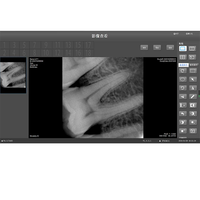 Digital X-ray Sensor Intraoral Dental Xray sensor for sale