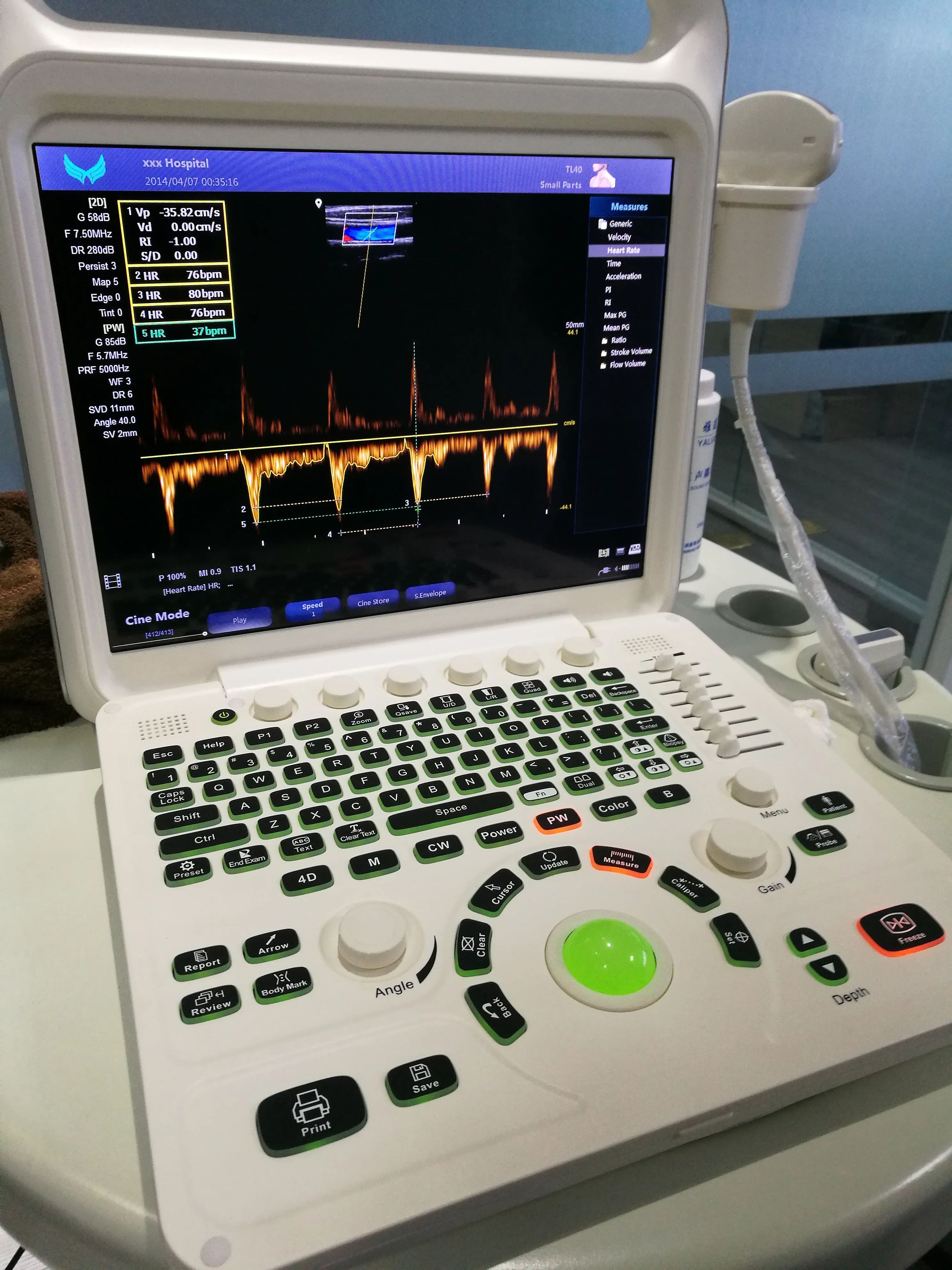 E60 Hot selling high performance LCD Ultrasound Machine Portable High Precision Color Medical Doppler