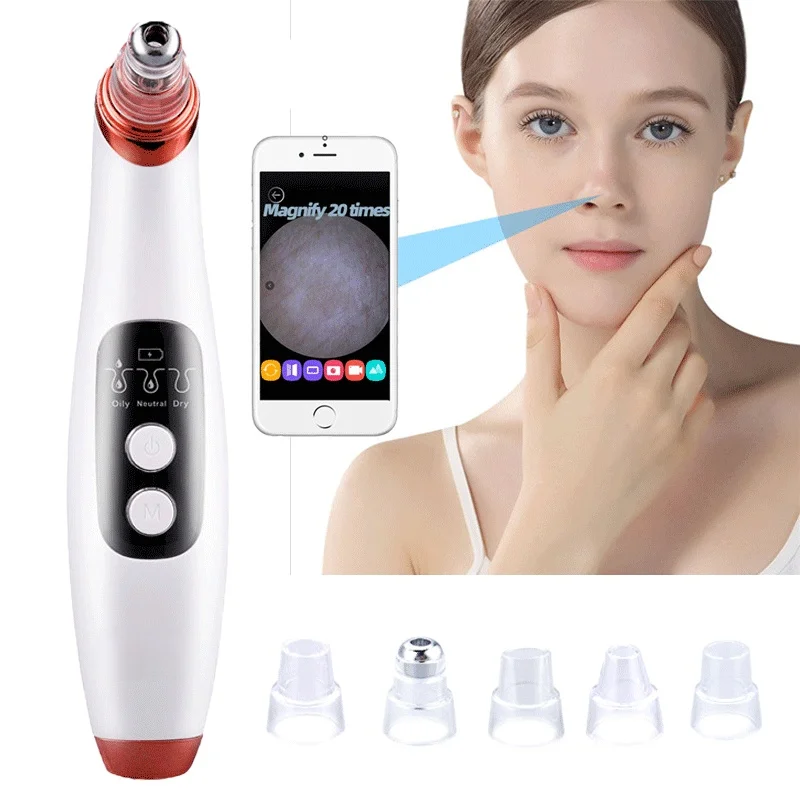 Fast USB Rechargeable blackhead whitehead acne removal blackhead remover vacuum cleansing with camera