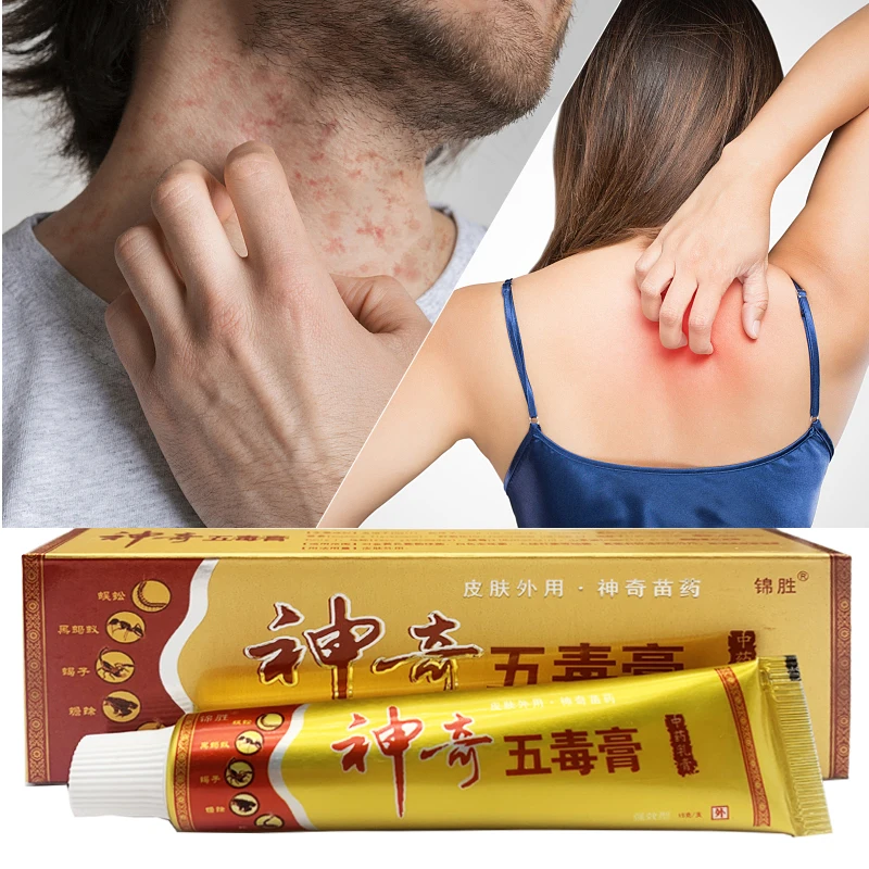 Magical Skin Cream Dermatitis and Eczema Skin Care Cream Antibacterial and Soothing Itching Cream for Tinea pedis Skin
