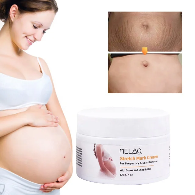 Low Price Wholesale MELAO Private Label Natural Organic Vegan Body Care Deep Acne Scar Anti Stretch Mark Removal Cream