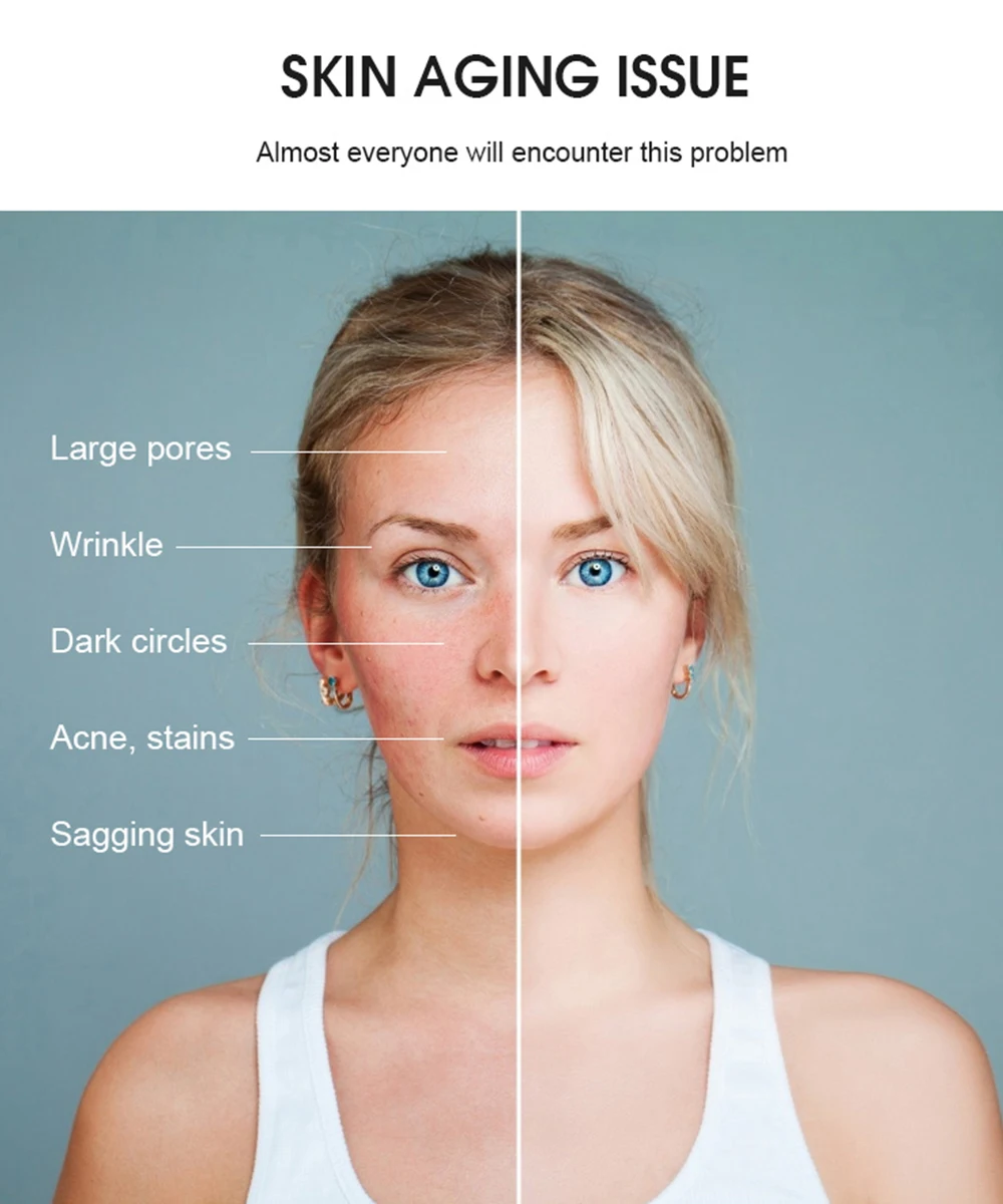 Professional Beauty Electric Diamond Peeling Oxygen Jet Hydrogen Oxgen Facial Diamond Microdermabrasion Machine