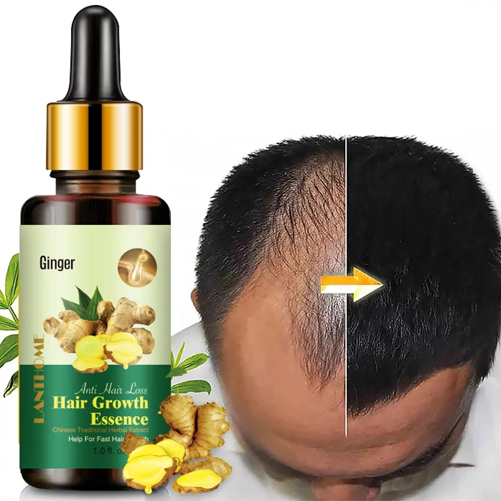 Wholesale 30ml Ginger Oil 7 Days Hair Growth Essential Oil For Hair Loss Treatment Regrowth Serum
