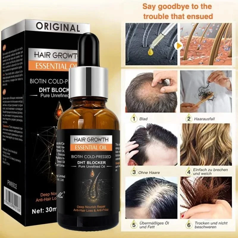 Opal OEM China Best Premium custom logo men herbs Ginger hair growth oil original dht blocker hair growth oil