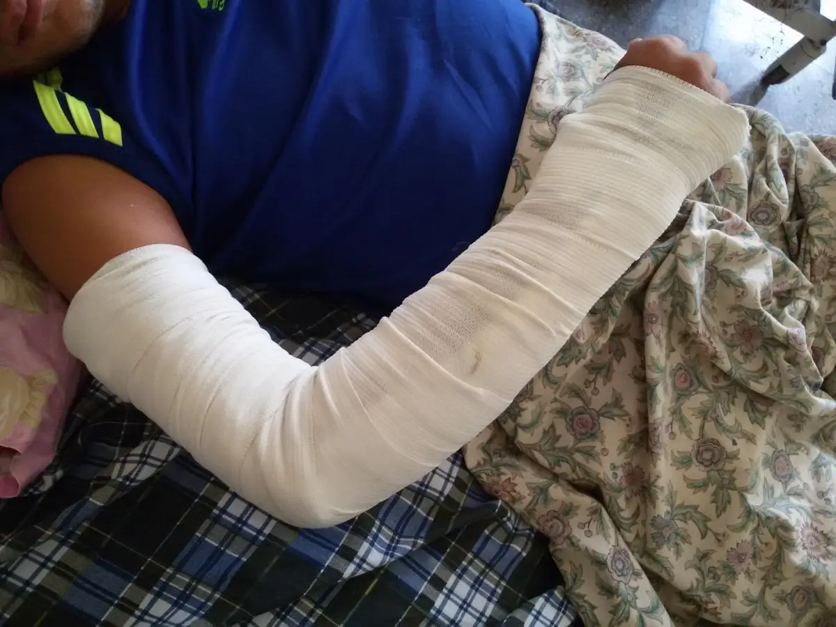 orthopedic  splint  (1119)