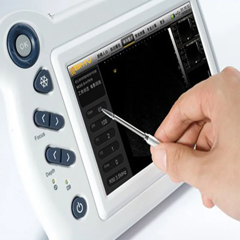 Портативный Женский ультразвуковой сканер Sonomaxx200 для диагностики здоровья Ультратонкий портативный аппарат