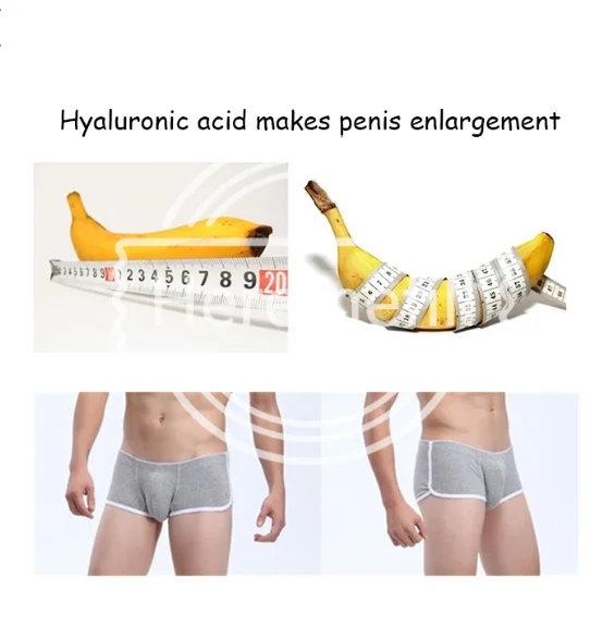 Korea Support To Order Korean Very Large Particles Of Hyaluronic Acid Dermal Fillers Penis Male Genital Filling Enlargement