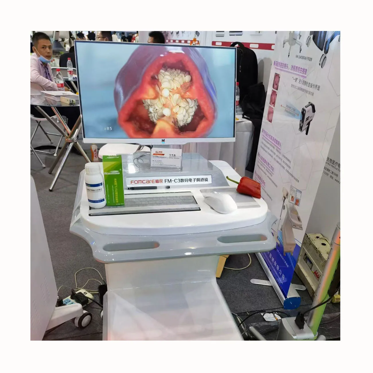 2023 New Design Medical Endoscope Portable Colposcope Digital Video Digital Colposcope For Gynecology