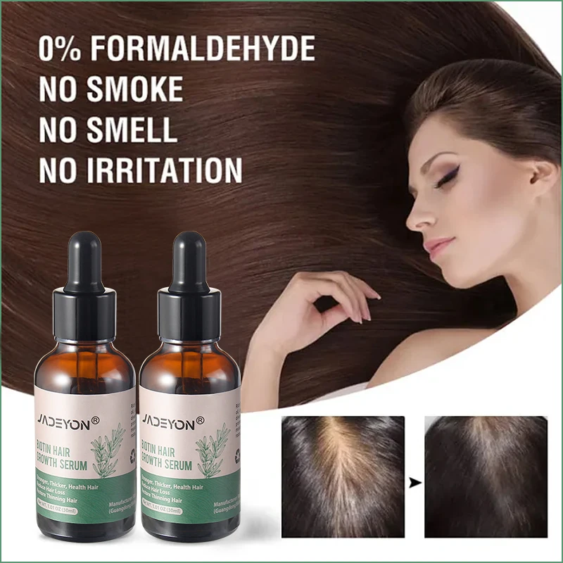 Private Label Natural Castor Oil For Hair Serum Anti Loss Regrowth For Bald Rosemary Oil Treatment Biotin Hair Growth Serum Oil