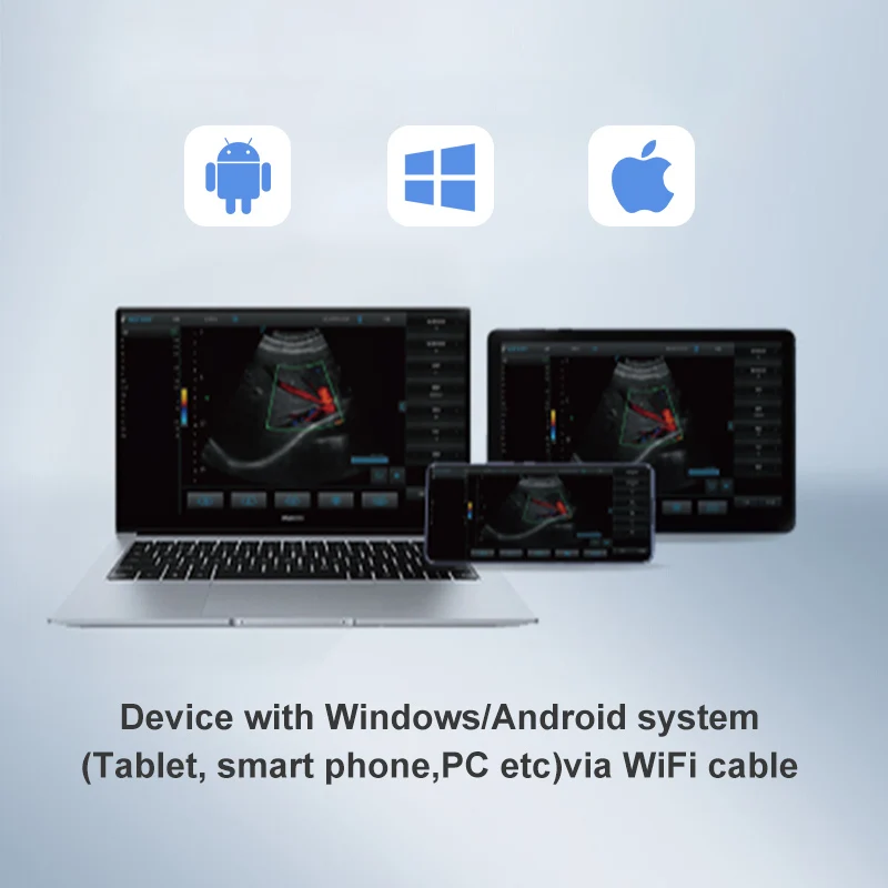 Yonker wifi wireless mini Double probe cow pet Vet handheld pregnancy scanner portable ultrasound machine veterinary for animals