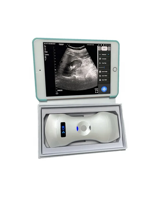 192 elements Color Doppler Ultrasound Wireless Ultrasound Scanner Wireless Double Heads 3 in 1