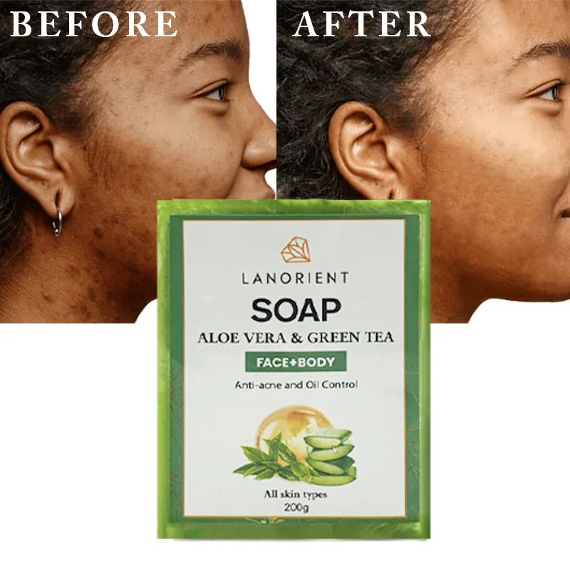 2024 New Face Body Care Products LANORIENT 200g Moisturizing Anti-Acne Repair Skin Damage Aloe Vera Handmade Soap